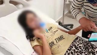 Aksaray'da skandal: Özel gereksinimli bir çocuğu darp etmişler! Bakanlıktan açıklama geldi