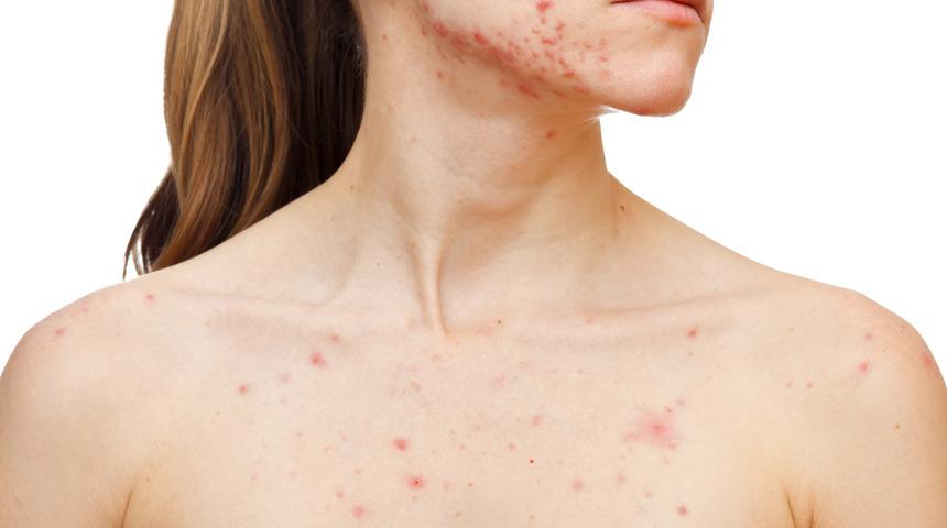 Limon değil kozmetik ürünü mübarek: Limondan gelen 5 güzellik sırrı