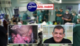 Anne karnındaki bebeği ameliyat eden profes&ouml;r konuştu! 