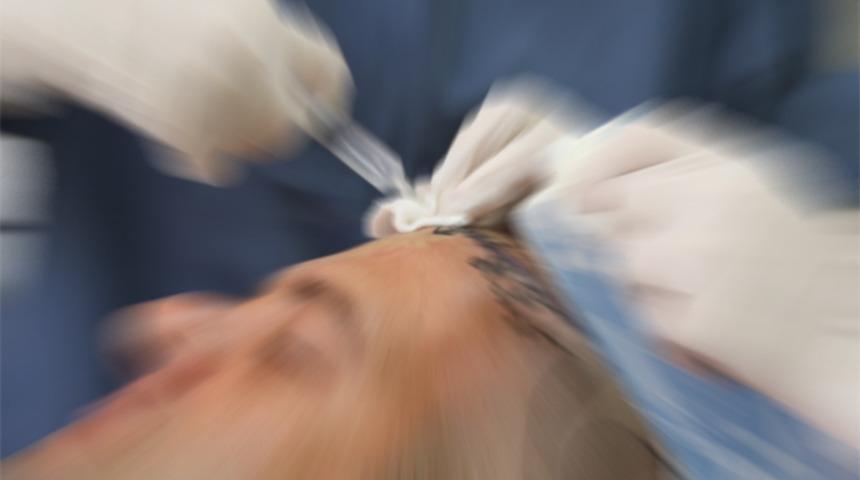 Saç ekiminde büyük tehlike!