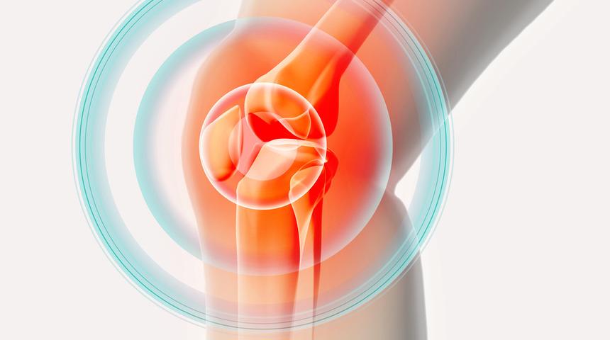 Sadece 2 malzemeyle eklem ağrılarına veda ediyoruz