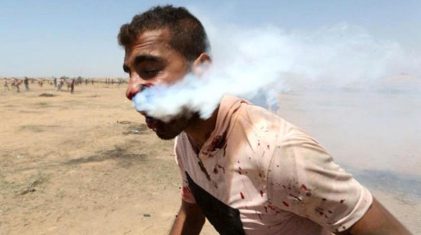 Ağzına gaz bombası isabet eden Filistinli’nin sağlık durumu belli oldu