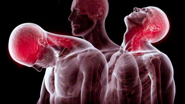 Boyun düzleşmesine ne iyi gelir? Boyun düzleşmesi egzersizleri ile evde tedavi mümkün mü, belirtileri neler?