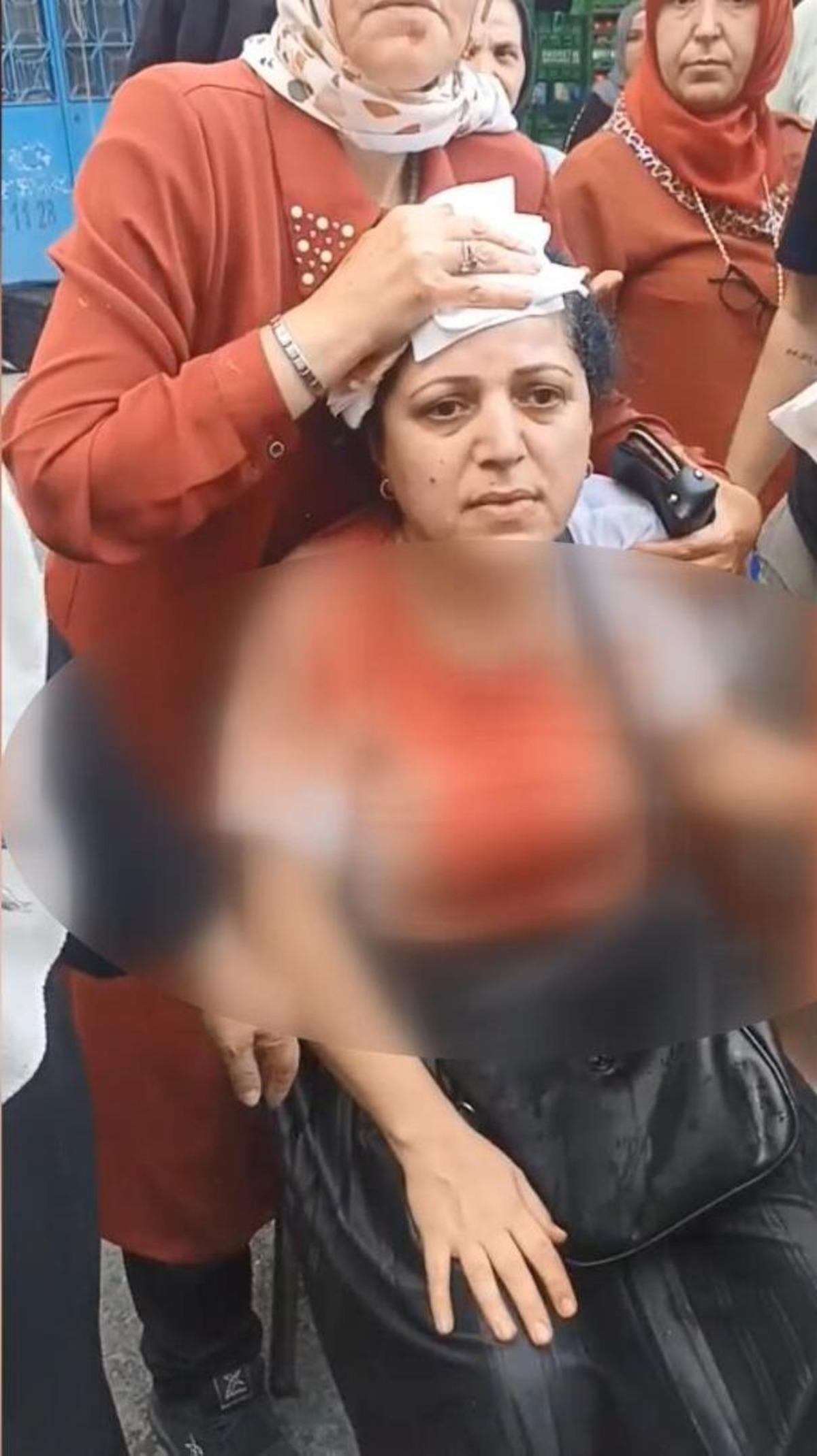 Armut seçme tartışmasında dehşet! Elindeki kalası kadının kafasına attı 3