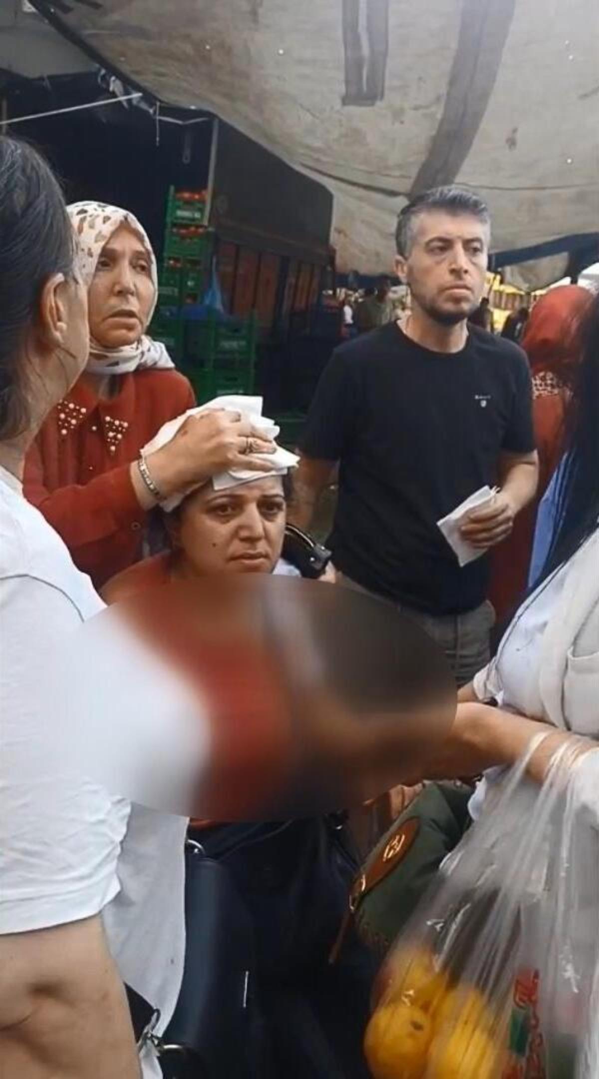 Armut seçme tartışmasında dehşet! Elindeki kalası kadının kafasına attı 1