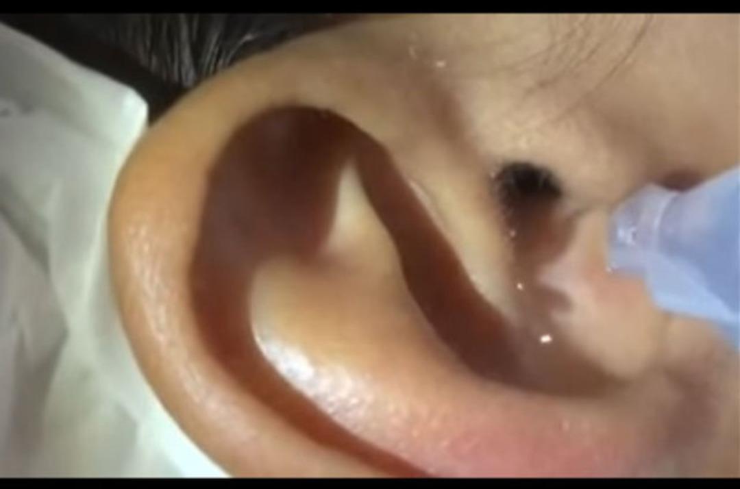 Kulağına su d&ouml;k&uuml;p beklediler! Olanları şaşkınlıkla izlediler