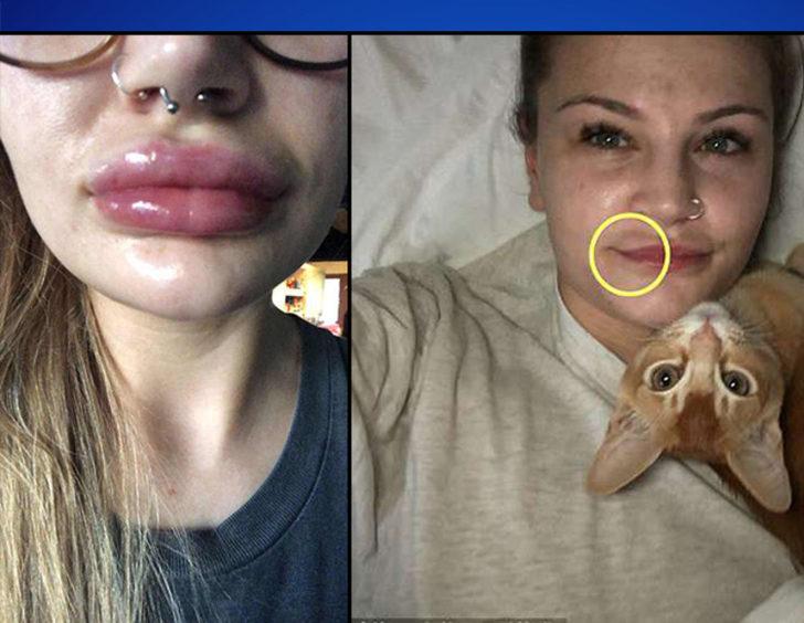 Bir skandal daha! Dudakları bu hale geldi, doktorun sözleri şoke etti: Oral seks... G1