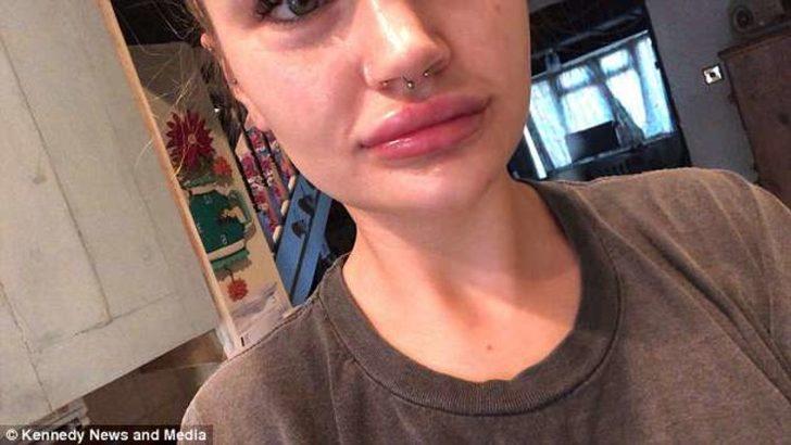 Bir skandal daha! Dudakları bu hale geldi, doktorun sözleri şoke etti: Oral seks... G4