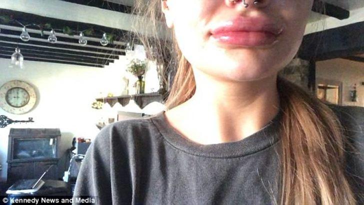 Bir skandal daha! Dudakları bu hale geldi, doktorun sözleri şoke etti: Oral seks... G5