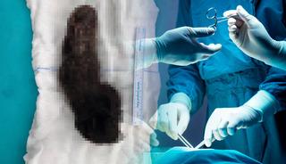 &Ccedil;ocuğun midesinden &ccedil;ıkanlar doktorları şaşkına &ccedil;evirdi