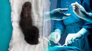 15 yaşındaki çocuğun midesinden çıkanlar doktorları şaşkına çevirdi