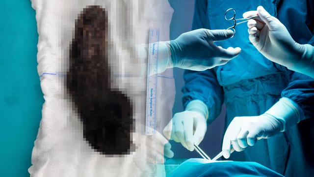 15 yaşındaki çocuğun midesinden çıkanlar doktorları şaşkına çevirdi