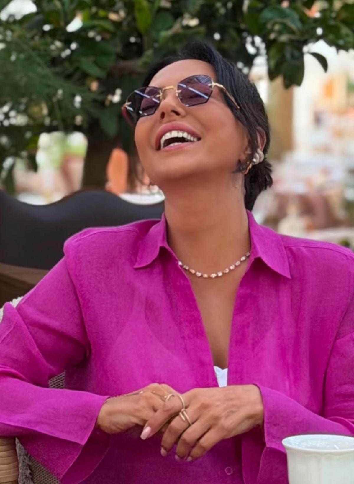 Estetiğe 10 milyon lira harcamıştı! Ebru Gündeş in son hali herkesi şaşırttı 3