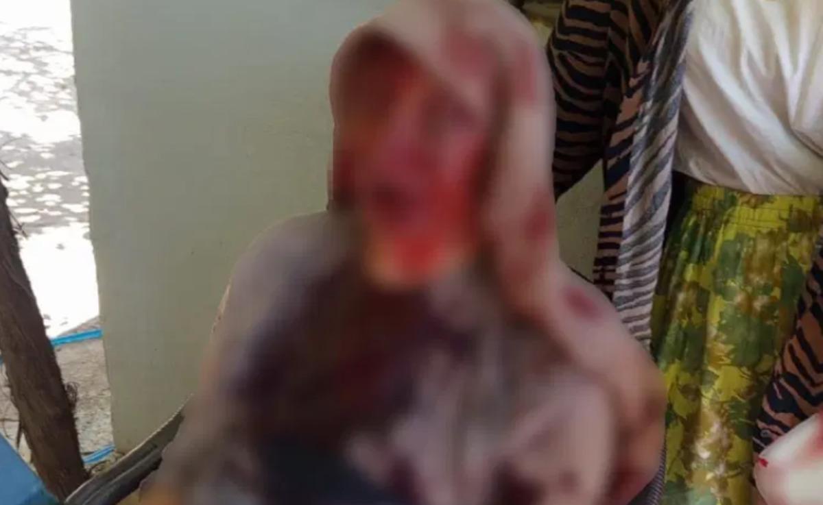 85 yaşındaki annesini elindeki sopayla öldüresiye dövdü 1