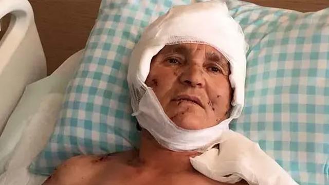 Köpekler saldırdı, yüzde 37 engelli kaldı! Yargıtay kararı kesinleşti: Tazminat ödenecek