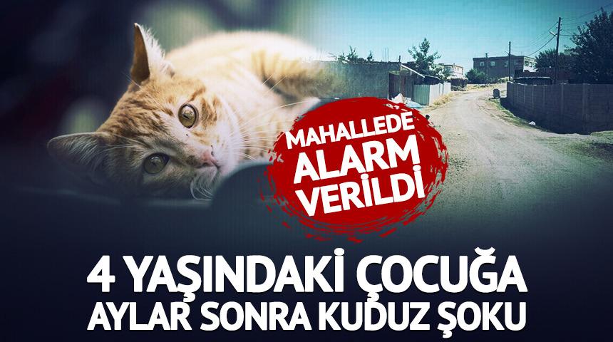 Kedi tarafından ısırılan &ccedil;ocuğa aylar sonra kuduz şoku