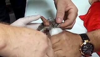 Bitlis&rsquo;te parmağı &ccedil;elik halkaya sıkışan &ccedil;ocuk itfaiye ekiplerince kurtarıldı