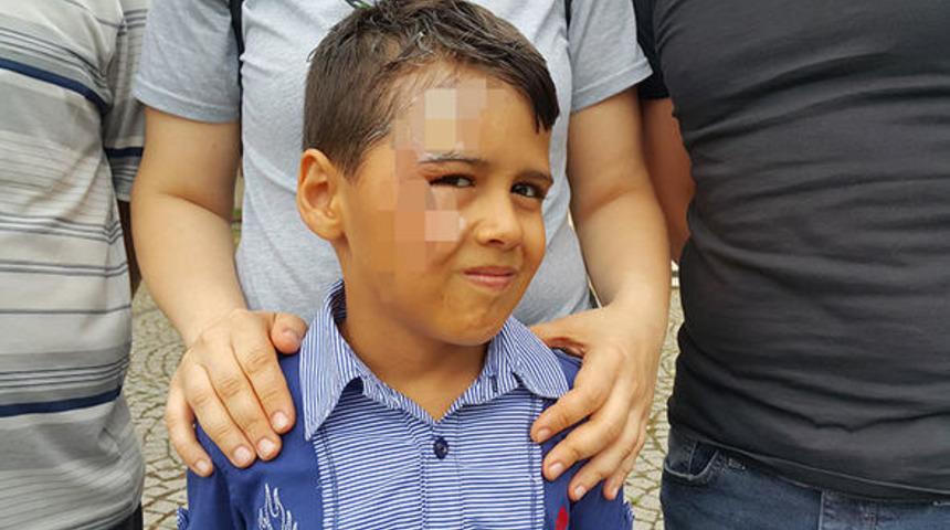 Bursa'da yolcu otobüsünde büyük skandal! 7 yaşındaki Efe bu hale geldi