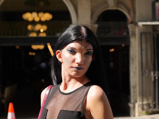 "Avatar" diye dalga ge&ccedil;tiler, estetik yaptırmasını s&ouml;ylediler