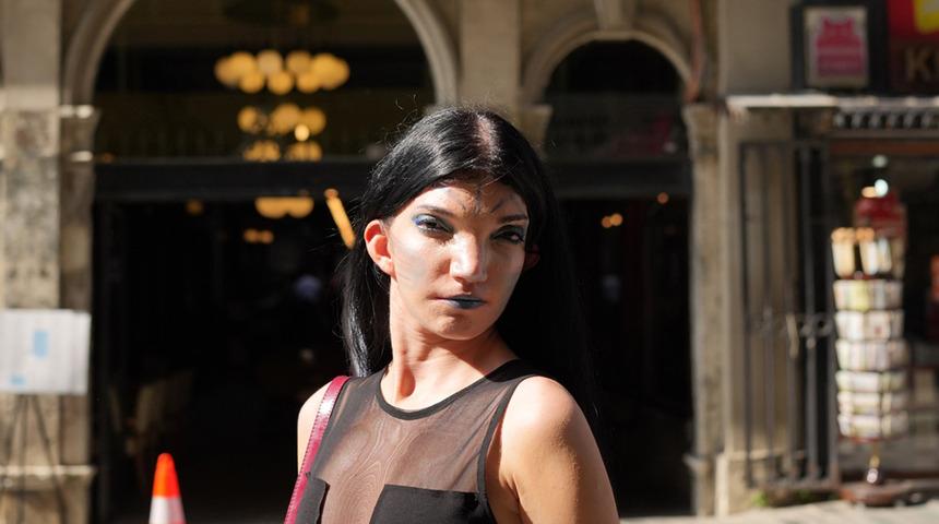 "Avatar" diye dalga ge&ccedil;tiler, estetik yaptırmasını s&ouml;ylediler: Keşke herkes benim gibi olsa
