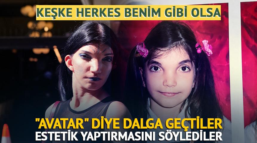 "Avatar" diye dalga ge&ccedil;tiler, estetik yaptırmasını s&ouml;ylediler
