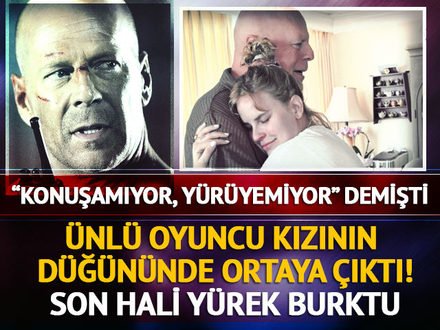 "Konuşamıyor" demişti! Efsane oyuncunun son hali y&uuml;rek burktu