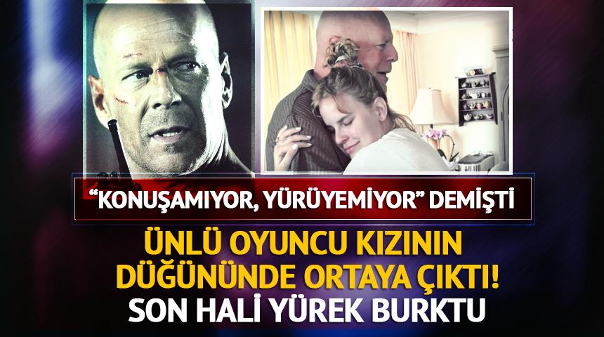 "Konuşamıyor" demişti! Efsane oyuncunun son hali y&uuml;rek burktu