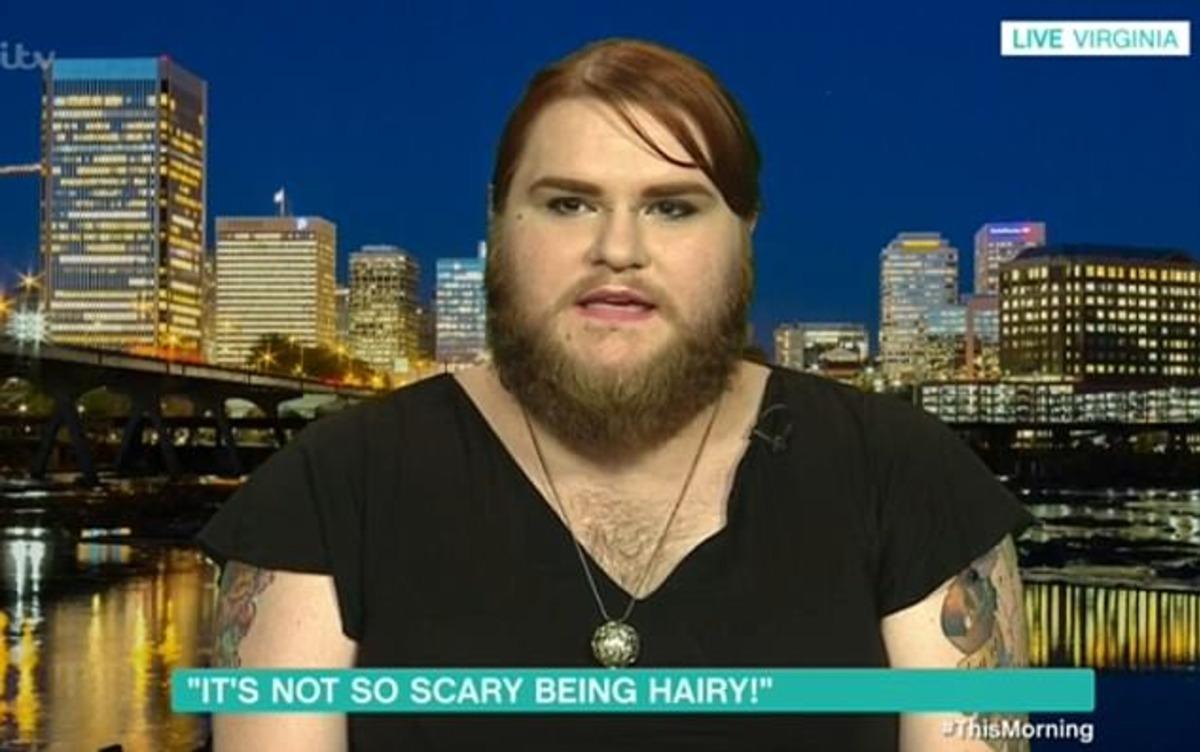 Sakalları y&uuml;z&uuml;nden yıllarca dışlanan kadın şimdi cesaretiyle &ouml;vg&uuml; topluyor