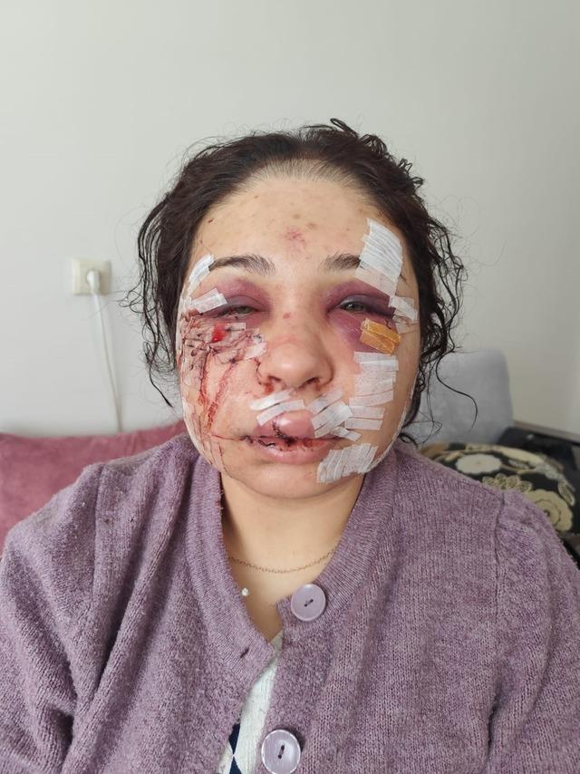 Boşanma aşamasındaki eşini darbeden polis memuruna hapis ve tahliye 2