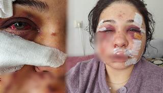 Polis eşi y&uuml;z&uuml;n&uuml; kesmişti! Şiddete uğrayan kadına hapis cezası
