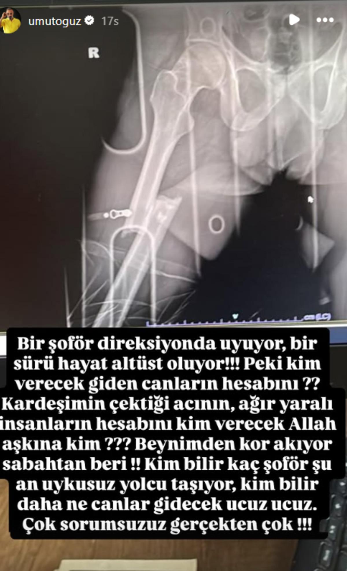 Okan Oğuz Daha 17 i&ccedil;in yola &ccedil;ıkmıştı! Abi Umut Oğuz kazanın detaylarını &ouml;ğrenince isyan etti 4