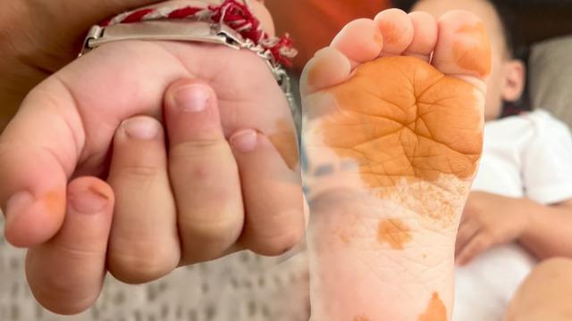 Sabah çocuğunun elini ayağını gören anne şoke oldu! Gerçek çok başka çıktı