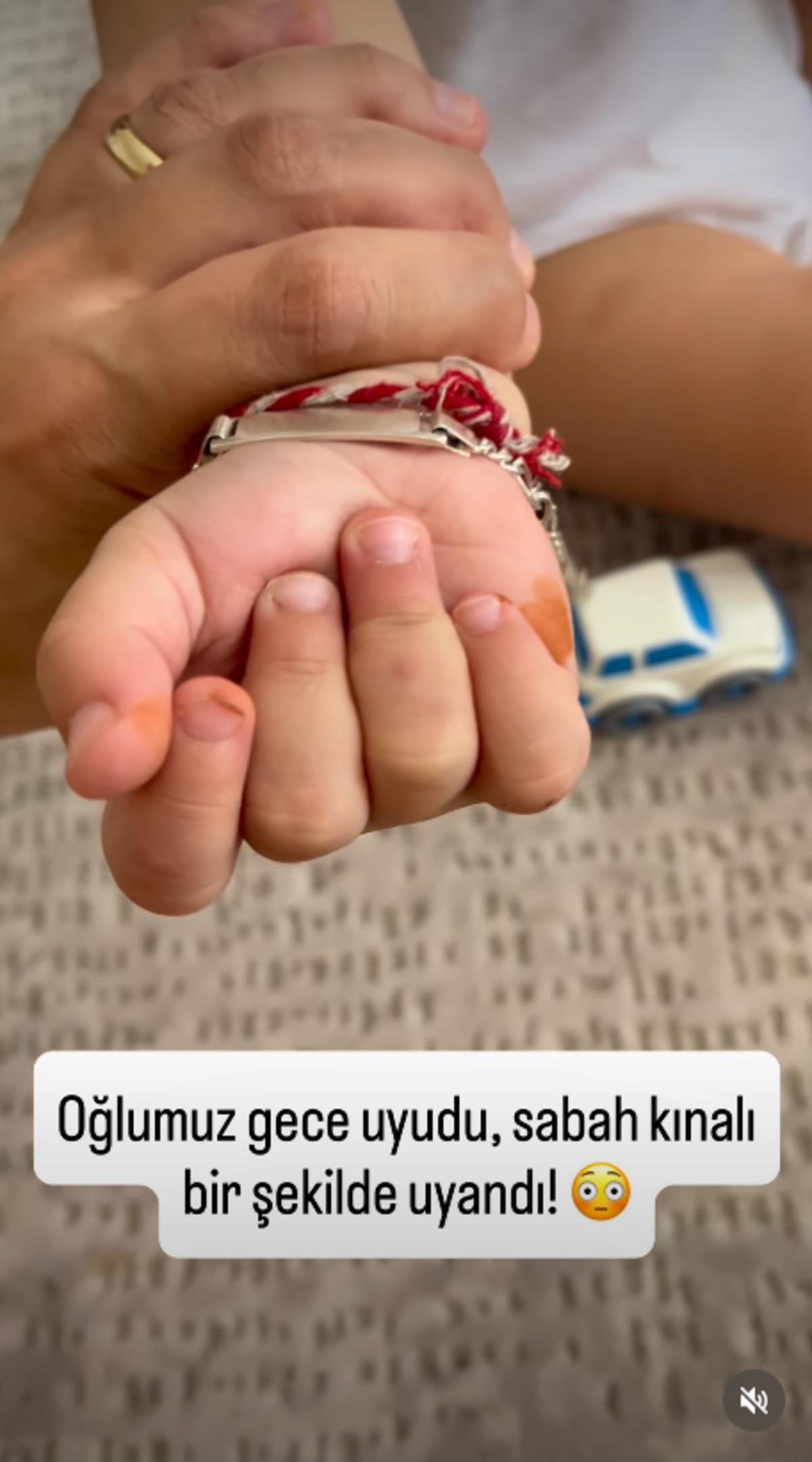 Sabah çocuğunun elini ayağını gören anne şoke oldu! Gerçek çok başka çıktı 2
