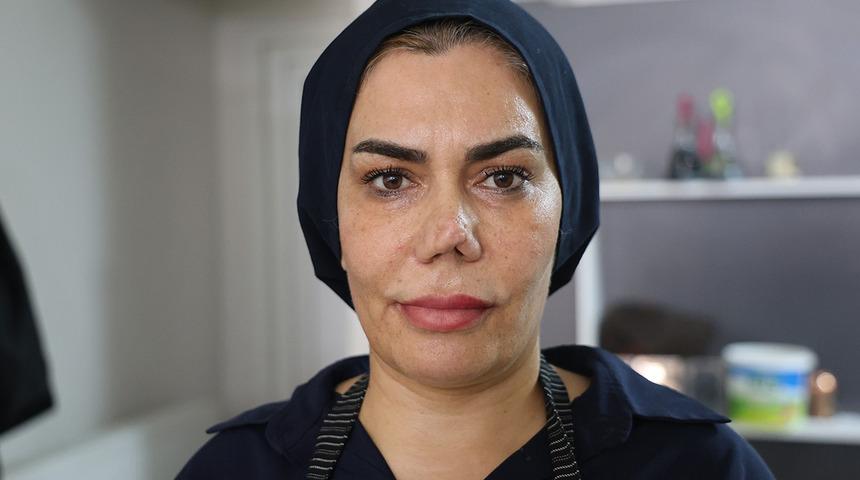 Burnu kırıldı, d&uuml;zelttirmek isterken hayatı kabusa d&ouml;nd&uuml;! &ldquo;Her seferinde farklı bir burun ortaya &ccedil;ıktı&rdquo;
