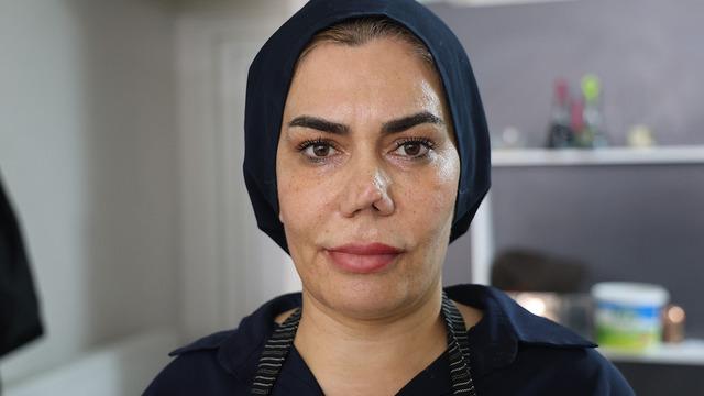 Burnu kırıldı, düzelttirmek isterken hayatı kabusa döndü! “Her seferinde farklı bir burun ortaya çıktı”
