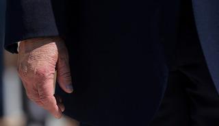 Trump'ın elindeki gizemli detay: Makyaj yapmış