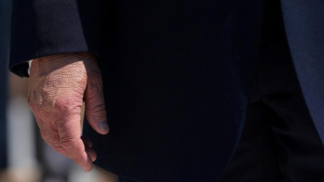 Trump'ın elindeki gizemli detay: Makyaj yapmış