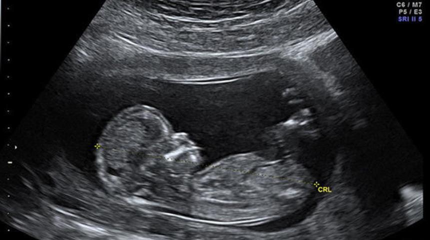 Doktora her gidişlerinde bebek sayısı arttı! 