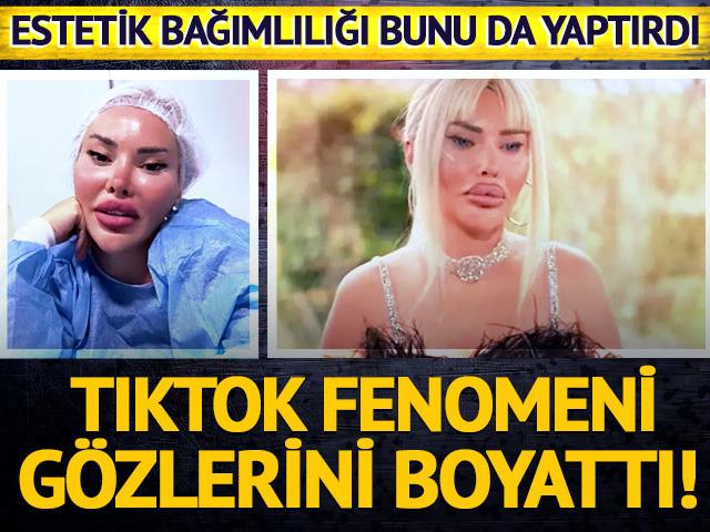 Estetik bağımlılığı bunu da yaptırdı! G&ouml;zlerini maviye boyattı