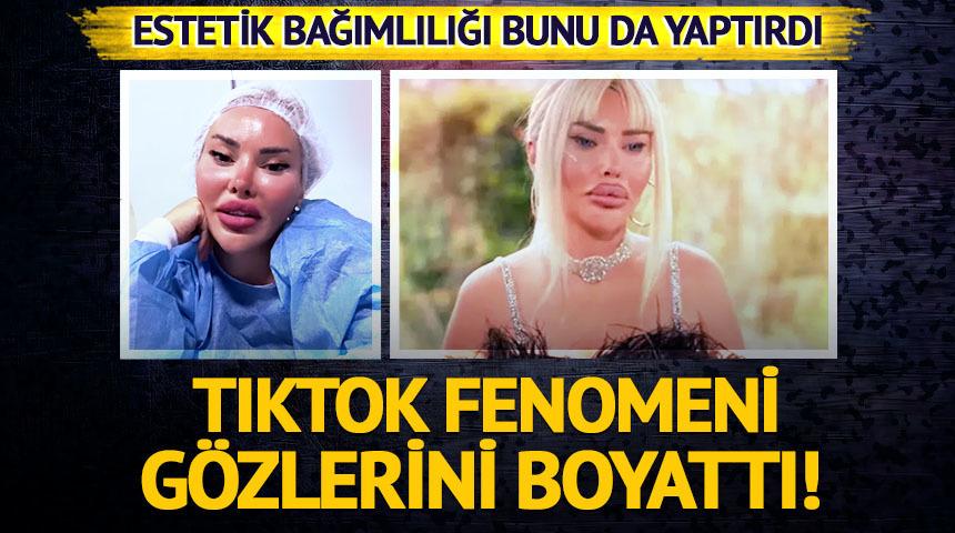 Estetik bağımlılığı bunu da yaptırdı! G&ouml;zlerini maviye boyattı