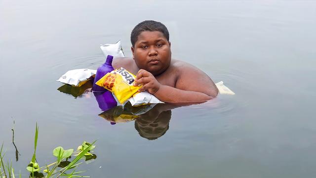 5 yıldır sudan çıkamıyor! 16 yaşındaki çocuğun gizemli hastalığı