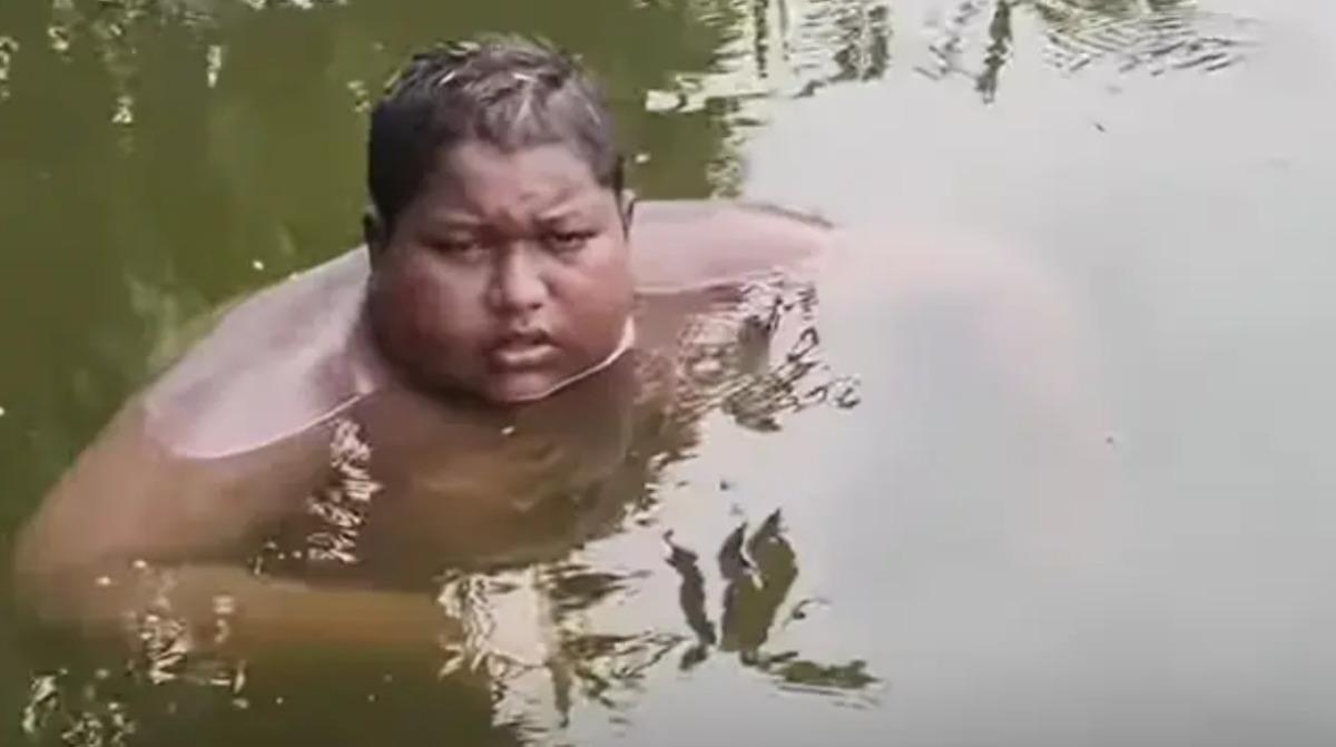 5 yıldır sudan &ccedil;ıkamıyor! 16 yaşındaki &ccedil;ocuğun gizemli hastalığı 1