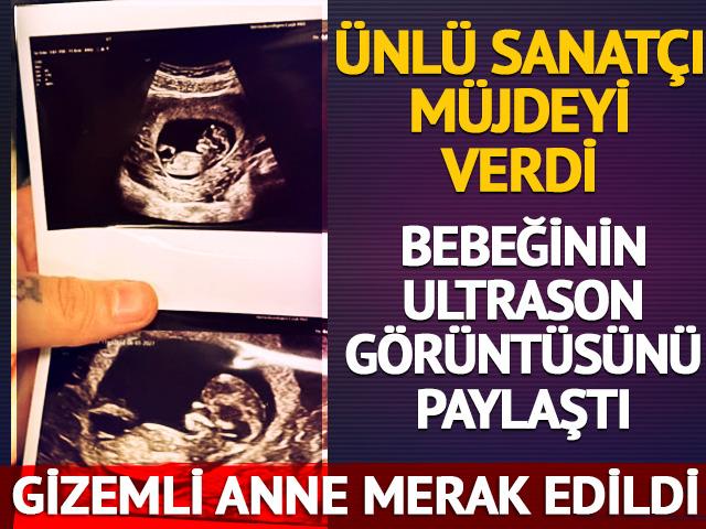 Ultrason g&ouml;r&uuml;nt&uuml;lerini paylaştı! Ufuk Beydemir baba oluyor