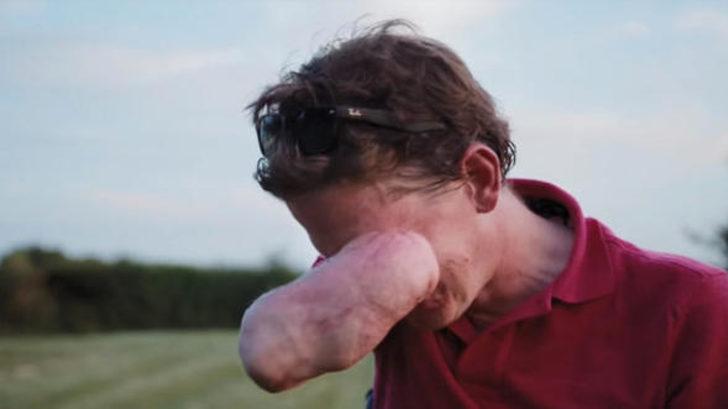 Et yiyen bakteri günden güne bedenini yok ediyor! G2