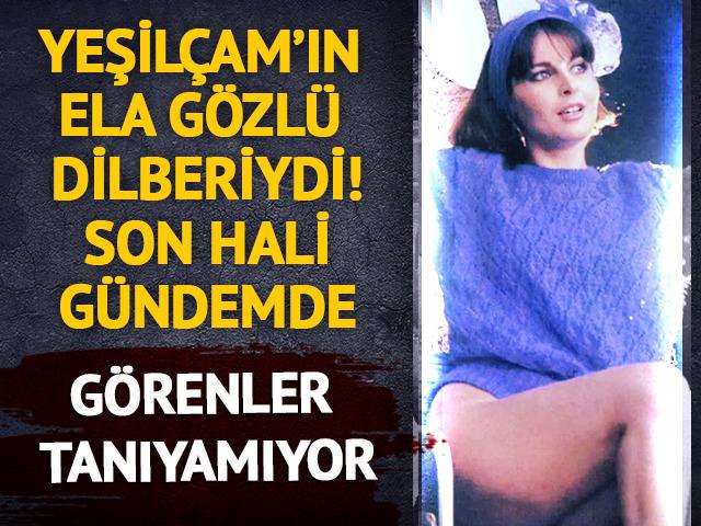 Yeşil&ccedil;am&rsquo;ın ela g&ouml;zl&uuml; dilberiydi! Son hali g&uuml;ndem oldu
