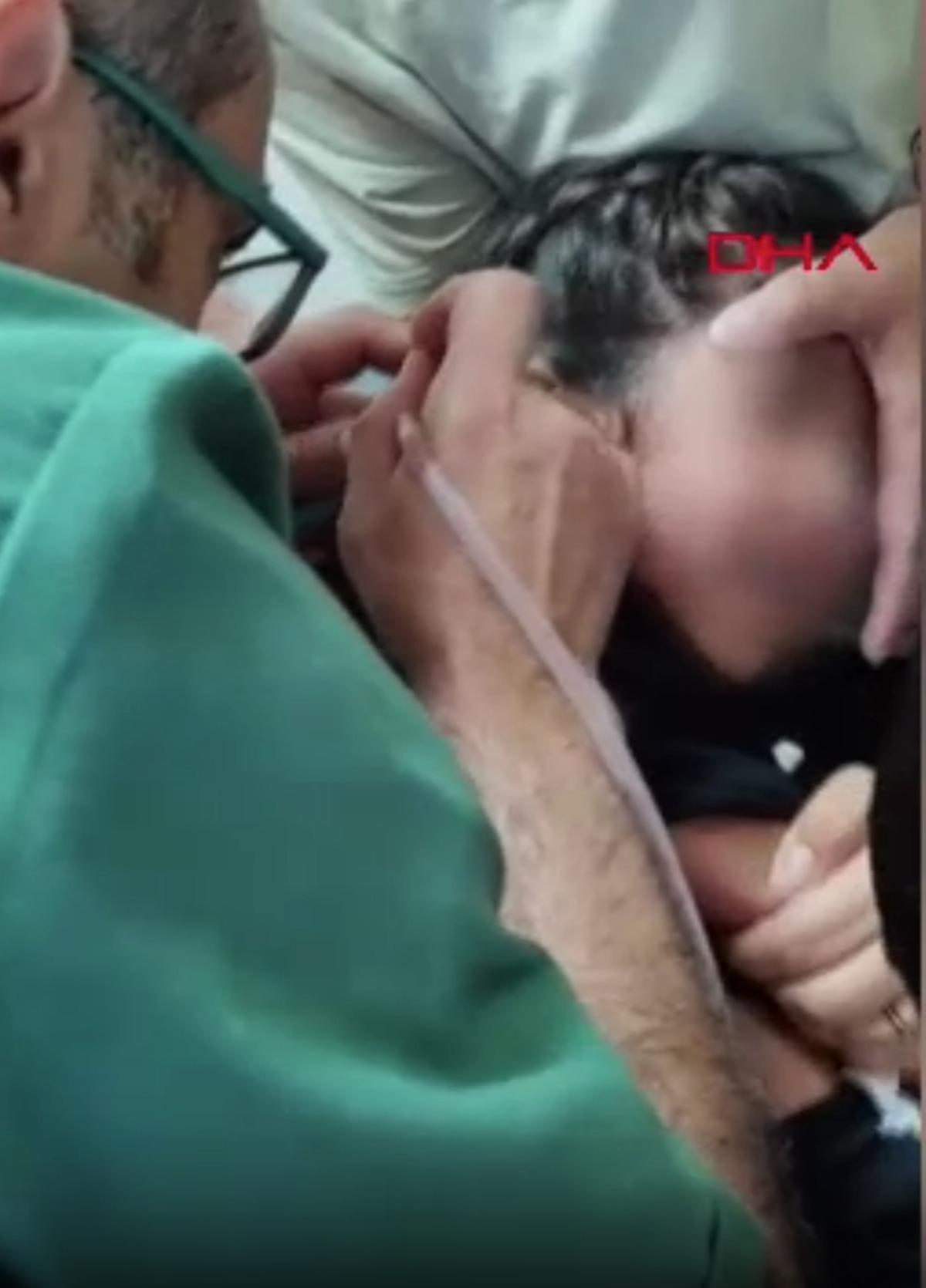 1 aydır ağrı &ccedil;ekiyordu: Kulağından canlı canlı &ccedil;ıkardılar 1