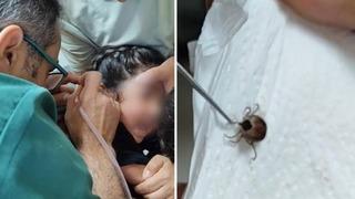 Son dakika: 1 aydır ağrı &ccedil;ekiyordu: Kulağından canlı canlı &ccedil;ıkardılar