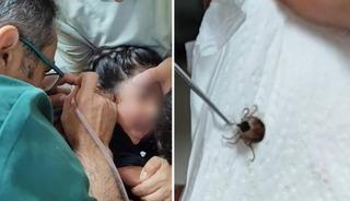 1 aydır kulak ağrısı &ccedil;ekiyordu: Kulağından canlı kene &ccedil;ıktı
