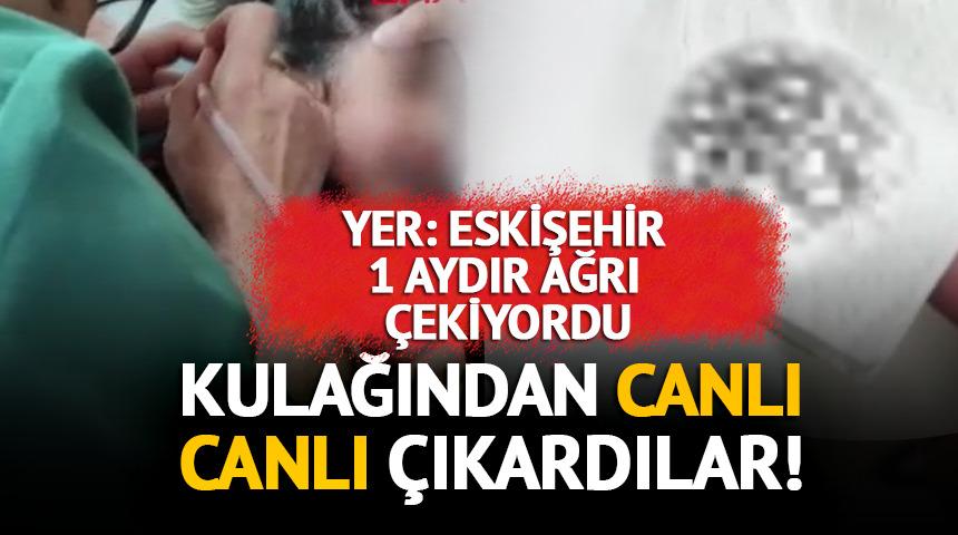 1 aydır ağrı &ccedil;ekiyordu: Kulağından canlı canlı &ccedil;ıkardılar