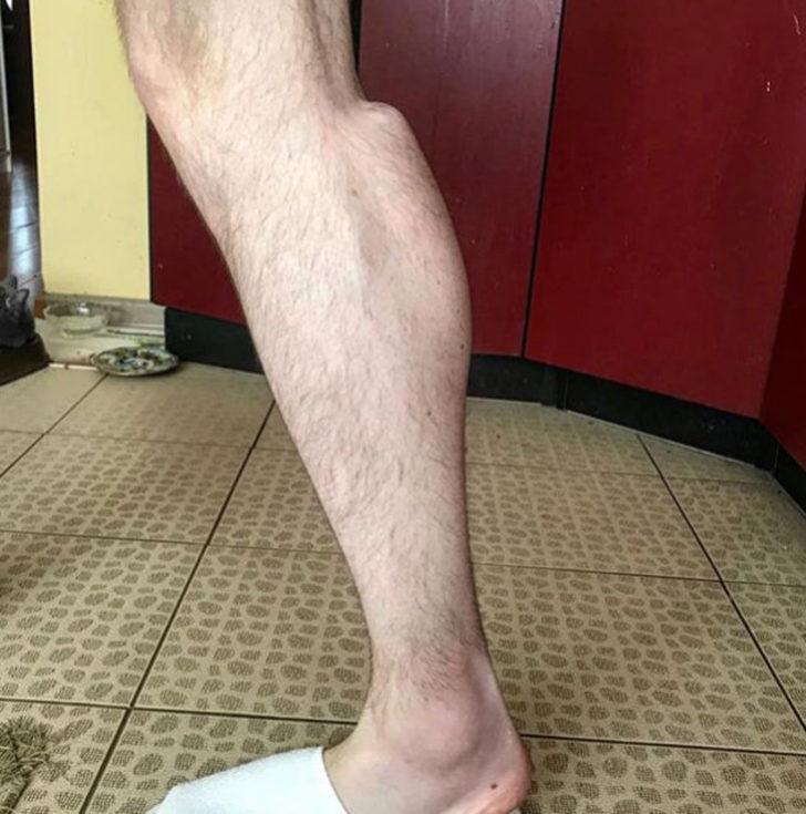 Kol kası yapmak için ölümü göze almıştı! Bu kez de... G2